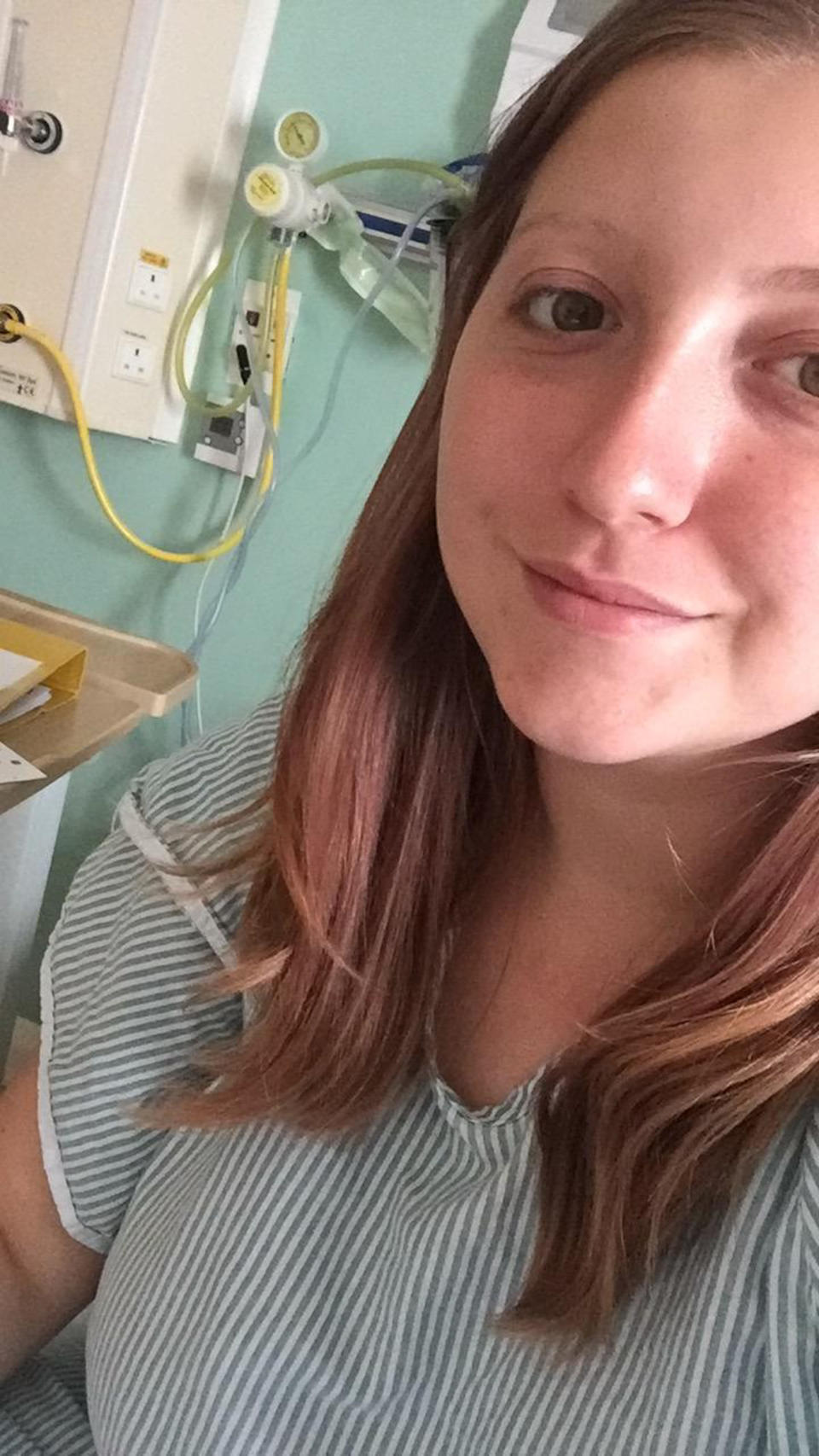 A 21-year-old woman goes through menopause after dealing with endometriosis 