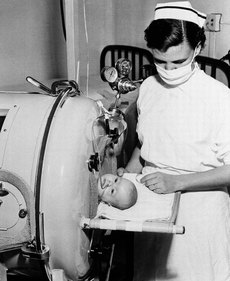 Two-month-old Martha Ann Murray is watched over by a nurse in an iron lung.