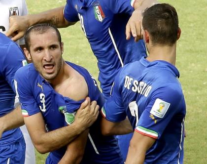 Italy&#39;s Giorgio Chiellini shows apparent teeth marks on his shoulder after the incident with Luis Suarez. (AP)