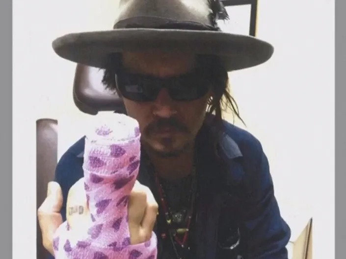 johnny depp finger amber heard trial bandages