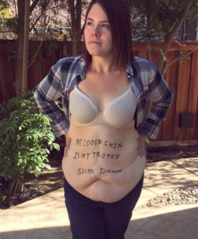 The body love advocate refuses to hide her shape. Photo: Instagram/mandas_muffintop