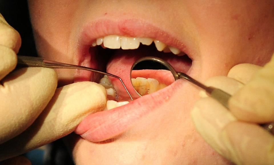 One person said that they are ‘resorting to buying dental cement to Germany’ because they can’t get help (PA)