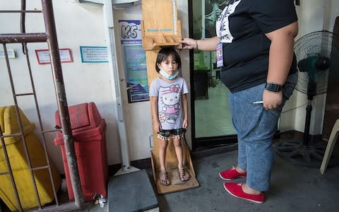 Zackia Kim Cajepe, four, is wasted and stunted. She weighed only 1.4kg when she was born and, at first, her family did not realise there was a problem. Now, they are worried - Credit: Simon Townsley