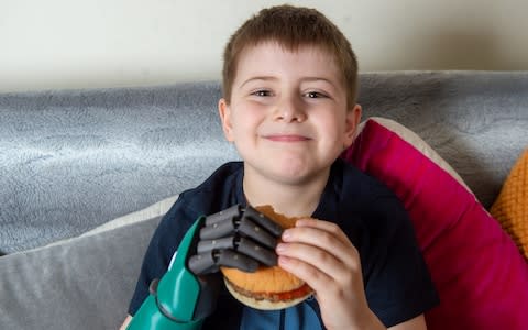 Freddie Cook 8, who was born with out a right hand is now the world's youngest recipient of a bionic hero arm - Credit: SWNS