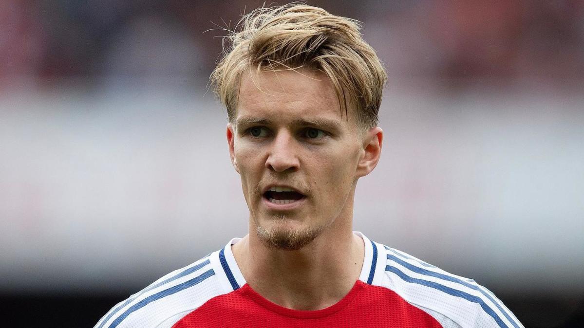 Odegaard ankle injury ‘quite significant’ – Arteta