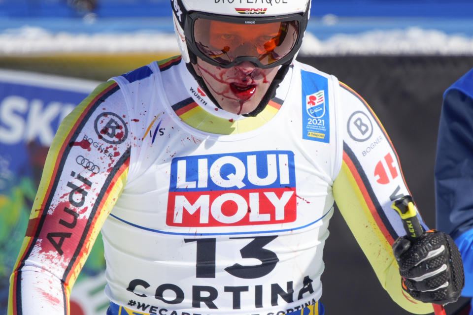 Germany's Romed Baumann, his face and right arm covered with blood, stands in the finish area after falling during the men's downhill, at the alpine ski World Championships in Cortina d'Ampezzo, Italy, Sunday, Feb.14, 2021. (AP Photo/Giovanni Auletta)