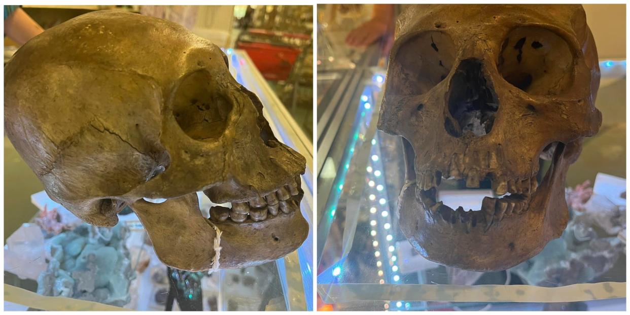 two pictures of a human skull