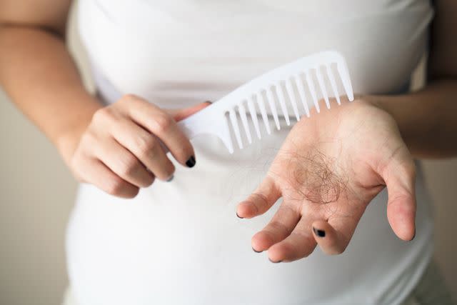 <p>burakkarademir / Getty Images</p> Hair from comb in hand