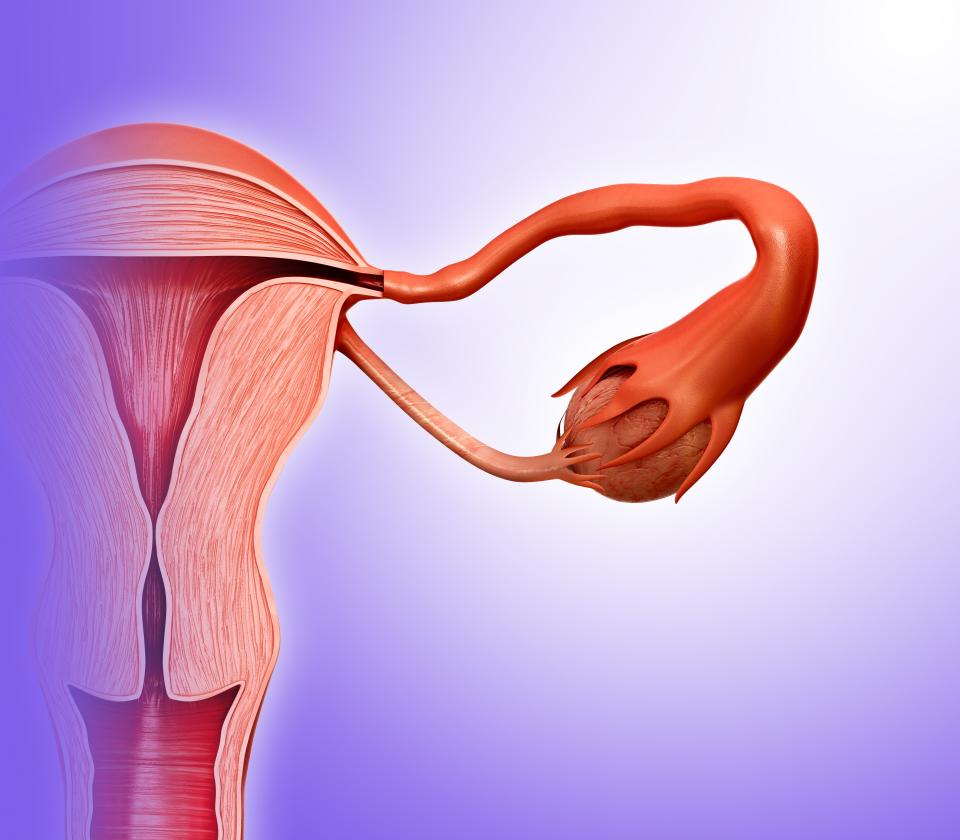 Illustration of the female reproductive system. About 30 per cent of women with fertility issues have blocked fallopian tubes, which connect the ovaries to the uterus. (Getty)