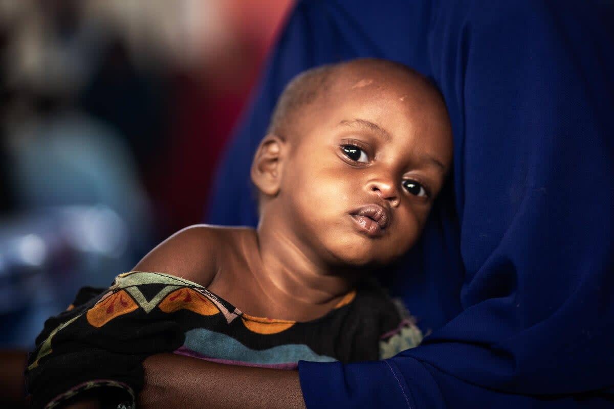 Sacdiyo’s baby Habibo who now lives in a makeshift canvas tent in a camp for internally displaced people (Fredrik Lerneryd/Save the Children)