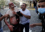 Civilians help an injured man at the explosion scene that hit the seaport of Beirut, Lebanon, Tuesday, Aug. 4, 2020. (AP Photo/Hussein Malla)