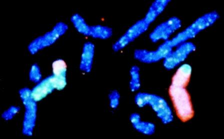 The blue and pink chromosomes have switched parts -- a translocation. Photo: Lawrence Livermore National Lab