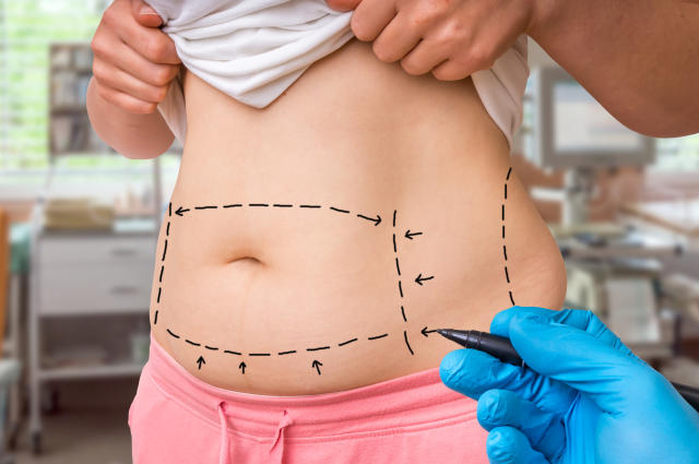 Cirugía de abdomen: todo lo que hay que saber antes de pasar por