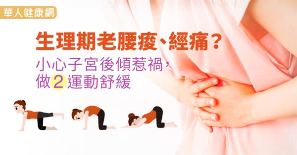 生理期老腰痠、經痛？小心子宮後傾惹禍，做2運動舒緩