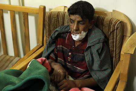 A wounded boy sits inside a hospital in Hasaka province, Syria, October 13, 2017. REUTERS/Rodi Said