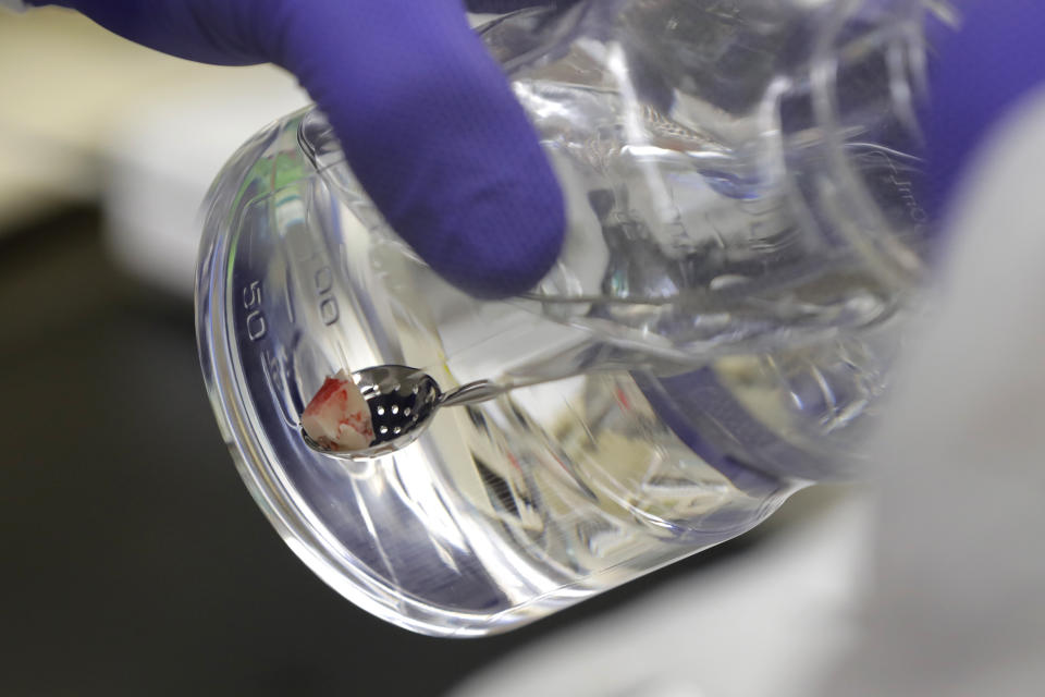 In this Jan. 14, 2020 photo, a piece of live brain tissue donated by Genette Hofmann who underwent brain surgery for epileptic seizures is kept alive in fluid so it can be immediately studied. As part of her surgery, Hofmann agreed to donate a small bit of her healthy brain tissue who were eager to study brain cells while they were still alive, joining a long line of epilepsy patients who've helped scientists reveal basic secrets of the brain. (AP Photo/Ted S. Warren)