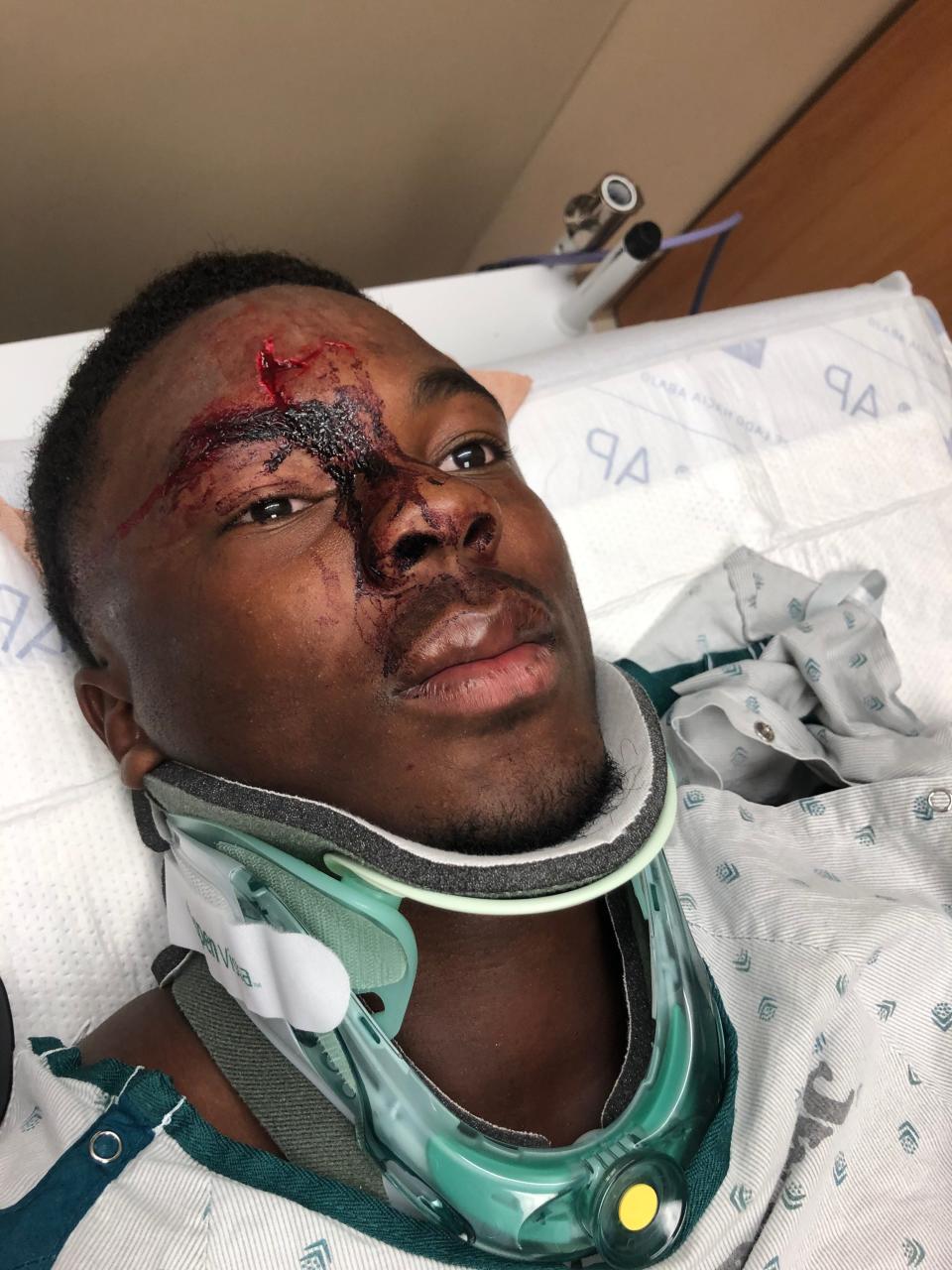 Iowa State receiver Daniel Jackson recovers in the hospital after fracturing his nasal cavity in a 2020 car accident.