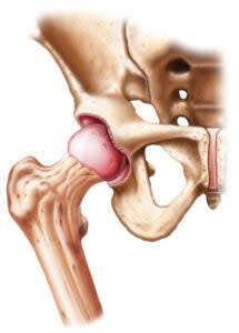 Anatomy illustration of the hip, which is a ball and socket joint and allows for hip openers that stretch the hip in various ways