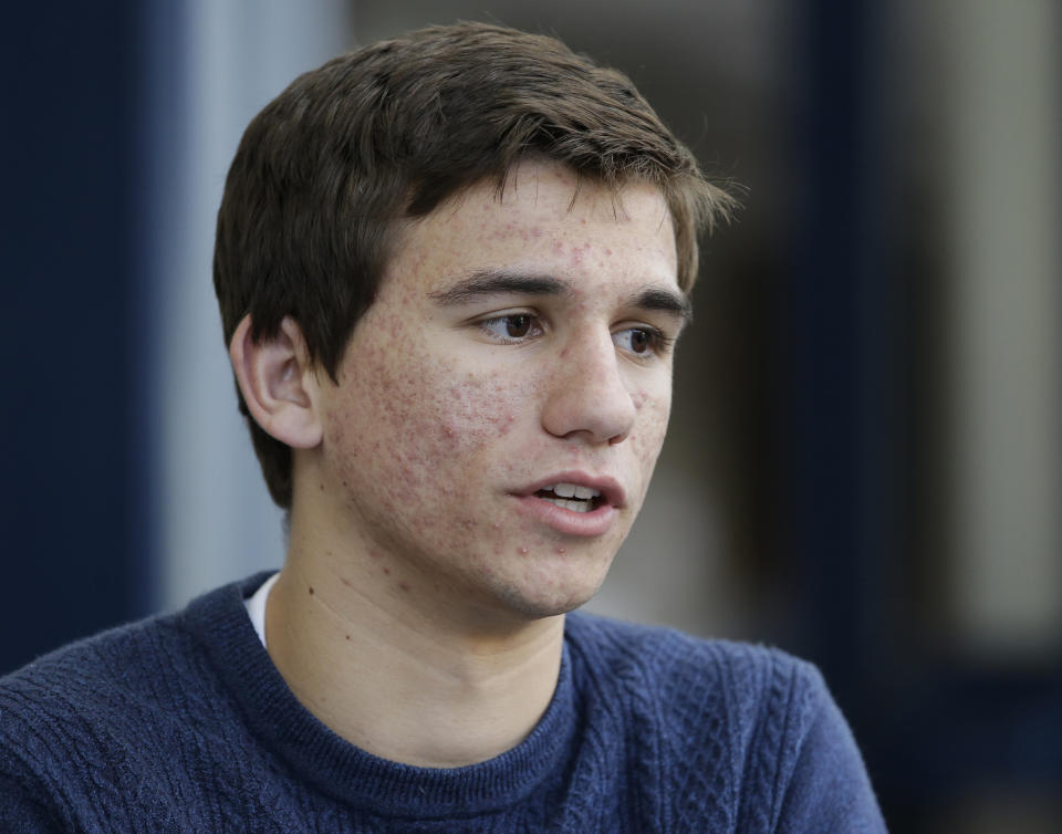 In this photo taken Friday, March 31, 2017, Tyler Christensen, a senior at Inderkum High, in Sacramento, Calif., said he is torn on the issue of lowering the voting age to 17, during an interview with the Associated Press. In an effort to increase voter participation by targeting teenagers, California lawmakers are considering a bill by Assemblyman Evan Low, D-Campbell, to lower the voting age to 17. Christensen said he liked the idea when he was 17, but since turning 18 in February, said "now that it doesn't matter anymore, I feel like a lot of people are still too immature." (AP Photo/Rich Pedroncelli)