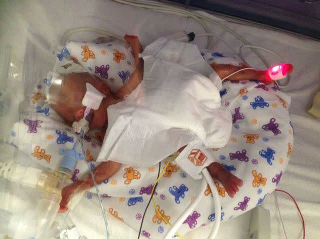 Tilly-Sue Davenport was born 16 weeks before she was due. Photo: South Wales Echo