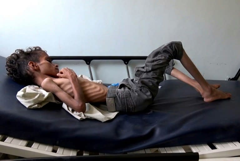 UN agencies say up to 14 million Yemenis would be at risk of starvation if fighting closes the port of Hodeida