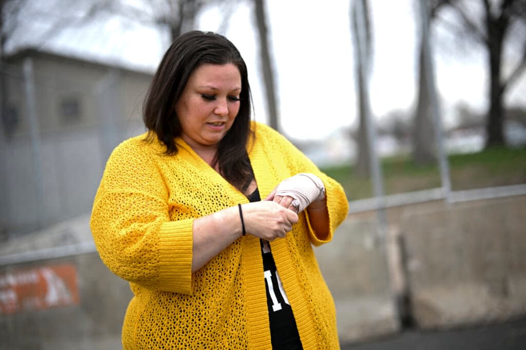 Katie Wright holds the hand on her injured wrist before a news conference Thursday, May 5, 2022 outside the Brooklyn Center Police Station in Brooklyn Center, Minn. (Aaron Lavinsky /Star Tribune via AP)