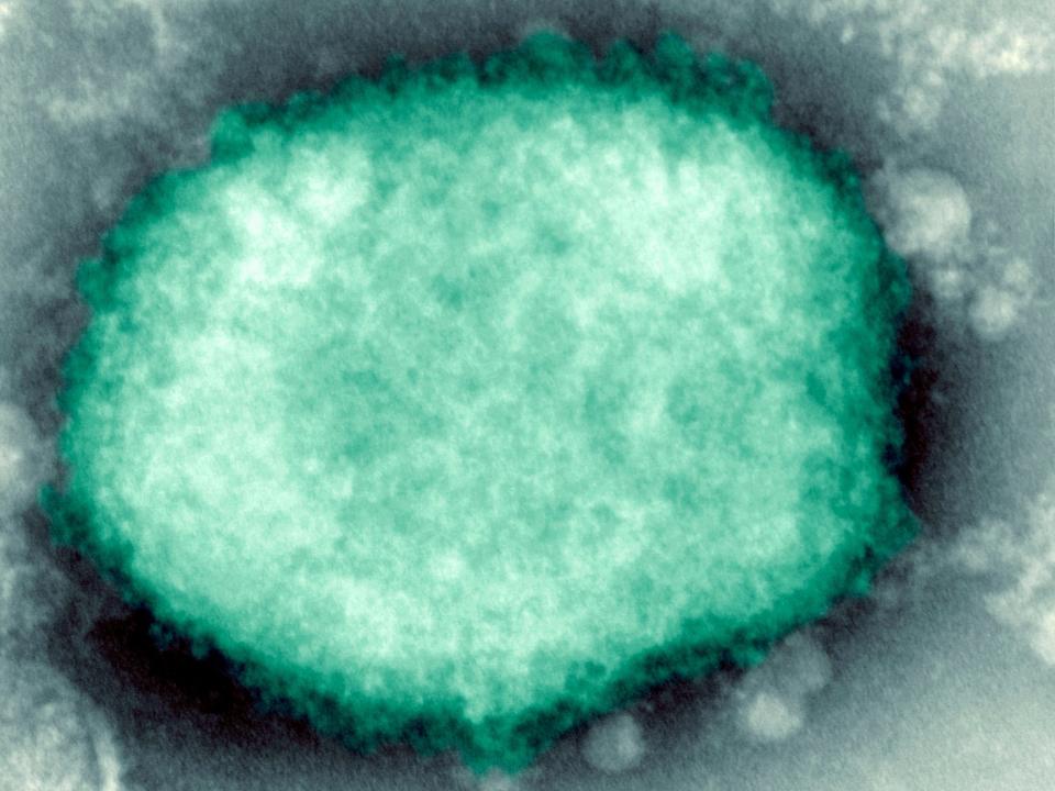 Monkeypox Virus Present In Human Vesicular Fluid.