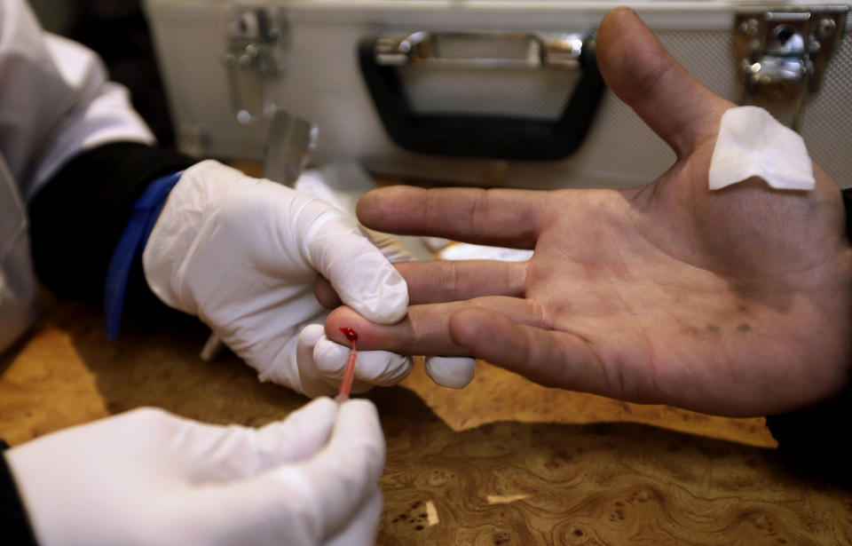 In this photo Wednesday, Nov. 21, 2012 file photo, a doctor takes an AIDS/HIV blood test from a drug user in a mobile laboratory in Odessa, Ukraine, Monday, Nov. 19, 2012. An estimated 230,000 Ukrainians, or about 0.8 percent of people aged 15 to 49 in a population of 46 million, are living with HIV, the virus that causes AIDS. Ahead of World AIDS day on Saturday, international organizations exhorted the Ukrainian government to increase funding for treatment and do more to prevent HIV from spreading from high-risk groups into the mainstream population, where it is even harder to manage and control. (Photo by Efrem Lukatsky)