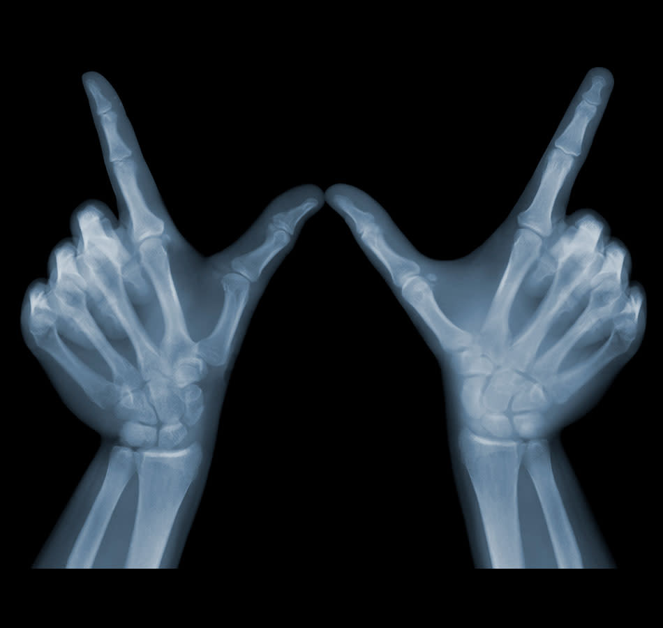 Fascinating X-ray photographs by Nick Veasey svkg 210612