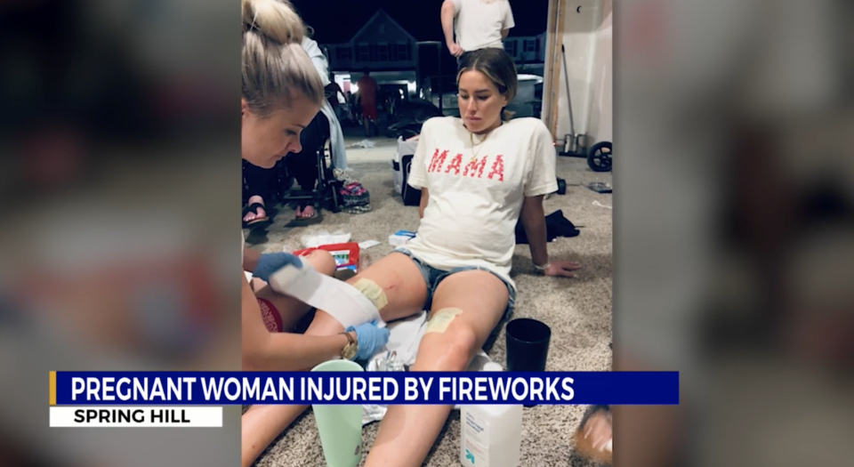 Katie Bihl was at a street party on July 4 when a firework exploded on her. Source: WKRN