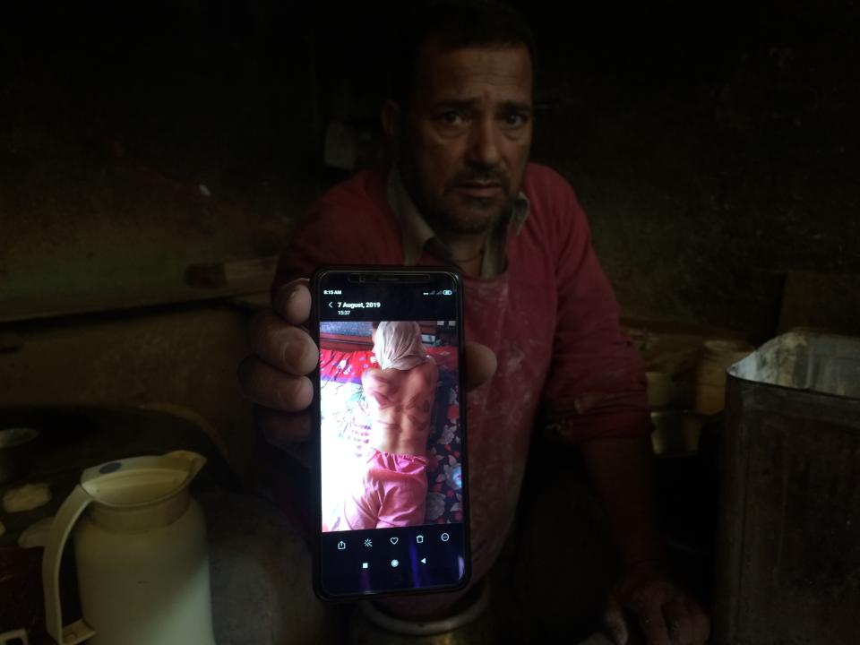 In this Monday, Aug. 26, 2019, photo, a Kashmiri baker Sonaullah Sofi displays a photograph of his son after he was allegedly tortured by Indian army soldiers at their bakery in the southern village of Parigam, Indian controlled Kashmir. The main city of Indian-controlled Kashmir presents a mostly deserted and subdued look, woven in a maze of razor wire. But drive out into the rural hinterland and residents in village after village narrate horrors of regular nightly raids by Indian army soldiers. Sofi's family was asleep when army troops raided his home. The soldiers took his two sons into a street, hitting them with gun butts, iron chains and sticks, Sofi said. “Helpless, I heard my sons scream as soldiers started beating them up mercilessly in the middle of the road,” Sofi said. ( AP Photo/Aijaz Hussain)