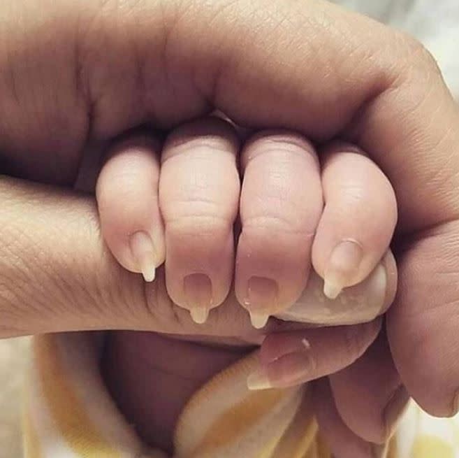 母親把寶寶的手指剪成「貓爪」，讓網友看了直呼，「超危險」。（圖／翻攝自Reddit討論區）