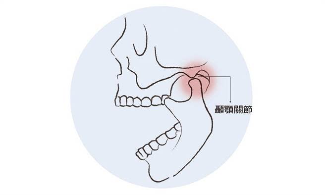 顳顎關節位於下顎骨二側後上端，和顱骨連接，可做為下巴運動的支點，負責嘴巴開閉的動作，因此講話、吃東西、咀嚼等都需要用到它。（圖片來源：康健雜誌）