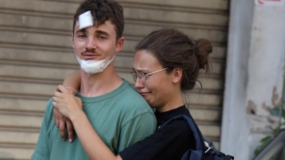 Dos jóvenes heridos tras la masiva explosión en Beirut.