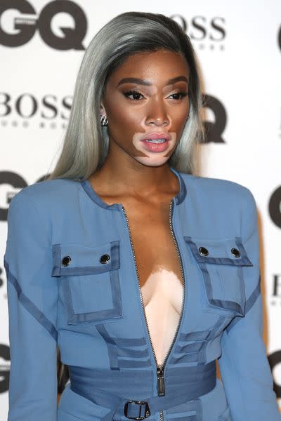 Winnie Harlow