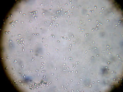 Nosema Ceranae Spores