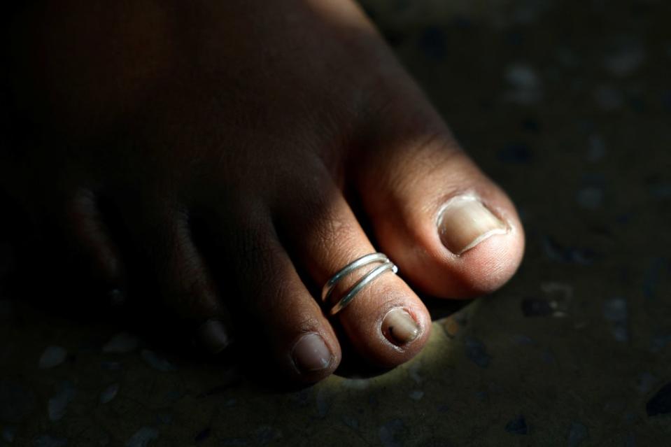 Close-up view of a Hindu woman’s foot wearing a toe ring, known as metti, in New Delhi, India. REUTERS