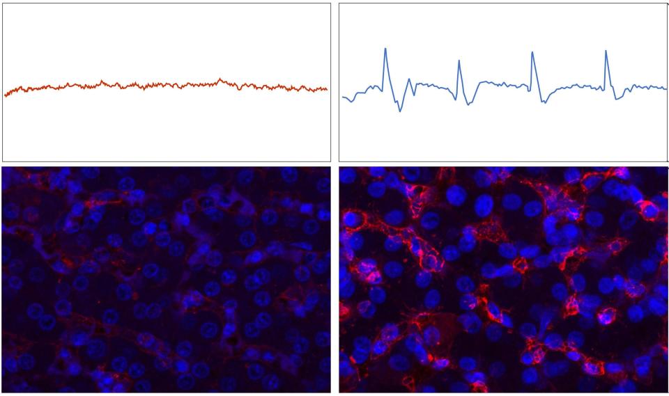 electrocardiogram shows mostly flat heartbeat with image of muted cells on the left versus clear heartbeat and bright cells on the right