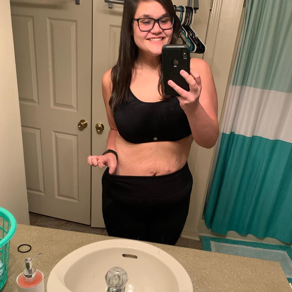 A photo of a woman wearing a black sports bra and leggings showing off her post-surgery weight loss.