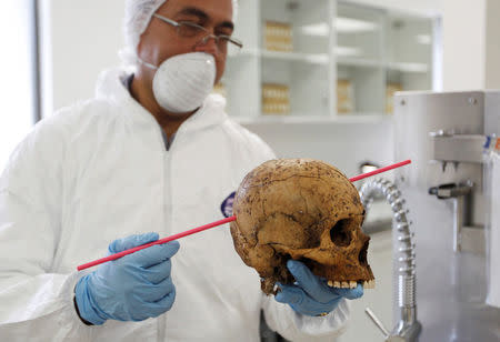 A forensic doctor examine the skull of an unidentified victim which is analyzed in the lab of the Attorney-General's office in Bogota, Colombia, May 5, 2017. REUTERS/Inaldo Perez