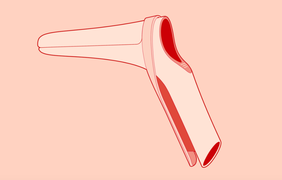 A group of women have redesigned the speculum [Photo: Frog/Yona]