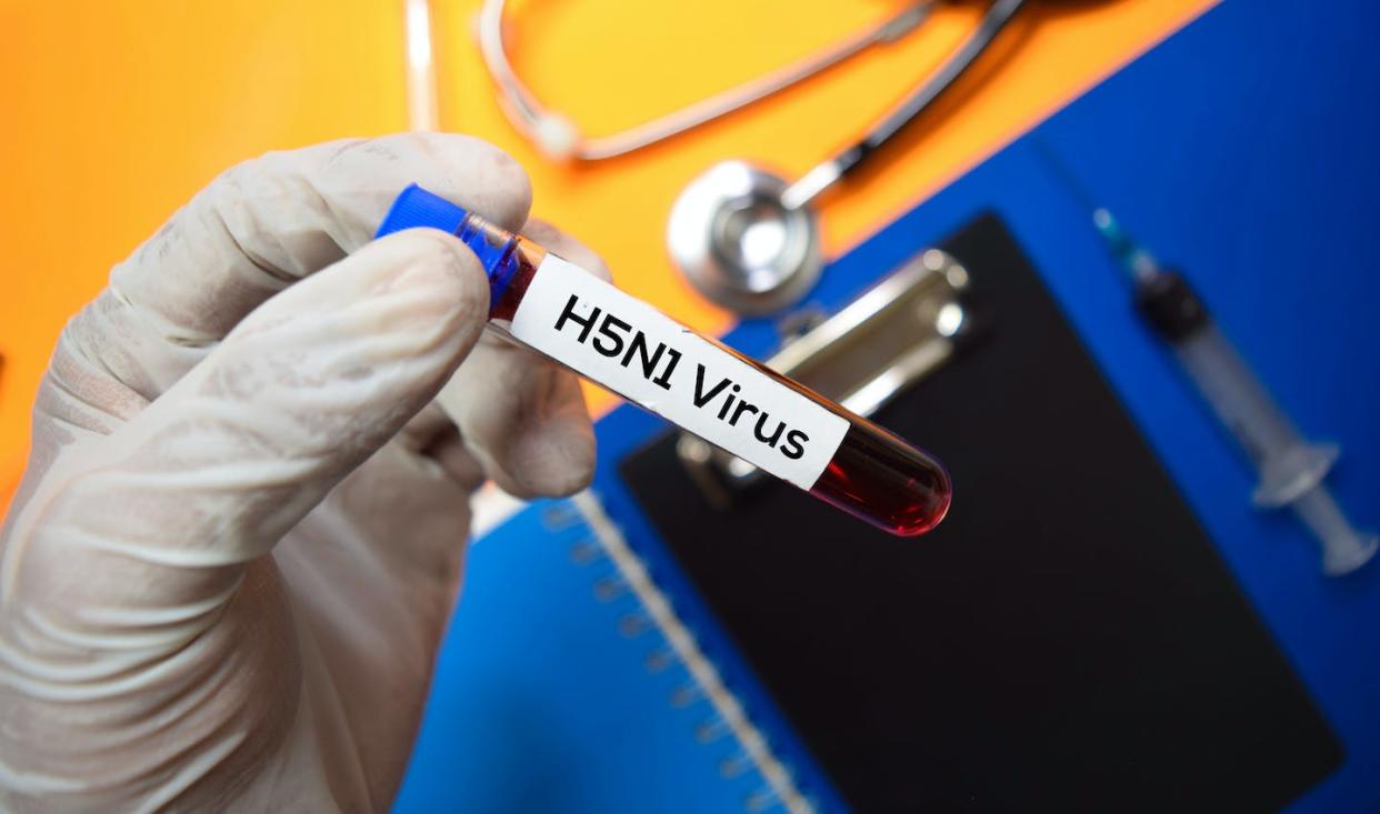 <a href="https://www.shutterstock.com/es/image-photo/h5n1-virus-blood-sample-top-view-1460376035" rel="nofollow noopener" target="_blank" data-ylk="slk:Shutterstock / bangoland;elm:context_link;itc:0;sec:content-canvas" class="link ">Shutterstock / bangoland</a>