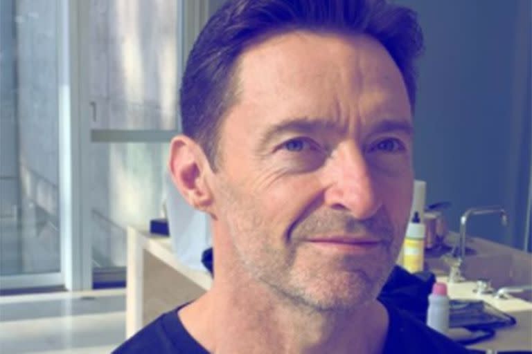 Hugh Jackman reveló que se sometió a una biopsia de piel y que los resultados “no son concluyentes”