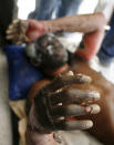 <p>An injured resident reacts after an earthquake in Port-au-Prince, Haiti, Jan. 13, 2010. (Photo: Eduardo Munoz/Reuters) </p>