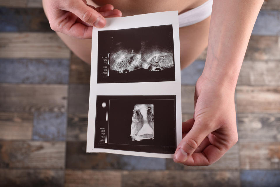 Young female holding echocardiogram of uterus test