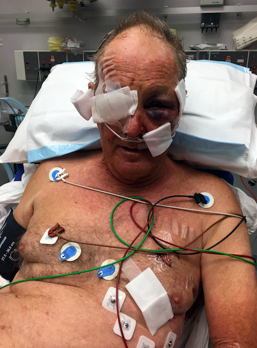 Kelvin Tennant, 72, was shot while riding his bike in Victoria on Saturday. Photo: AAP