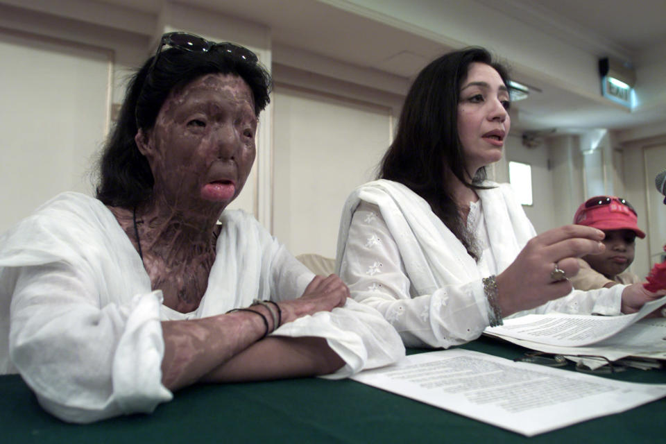 Acid attack victim