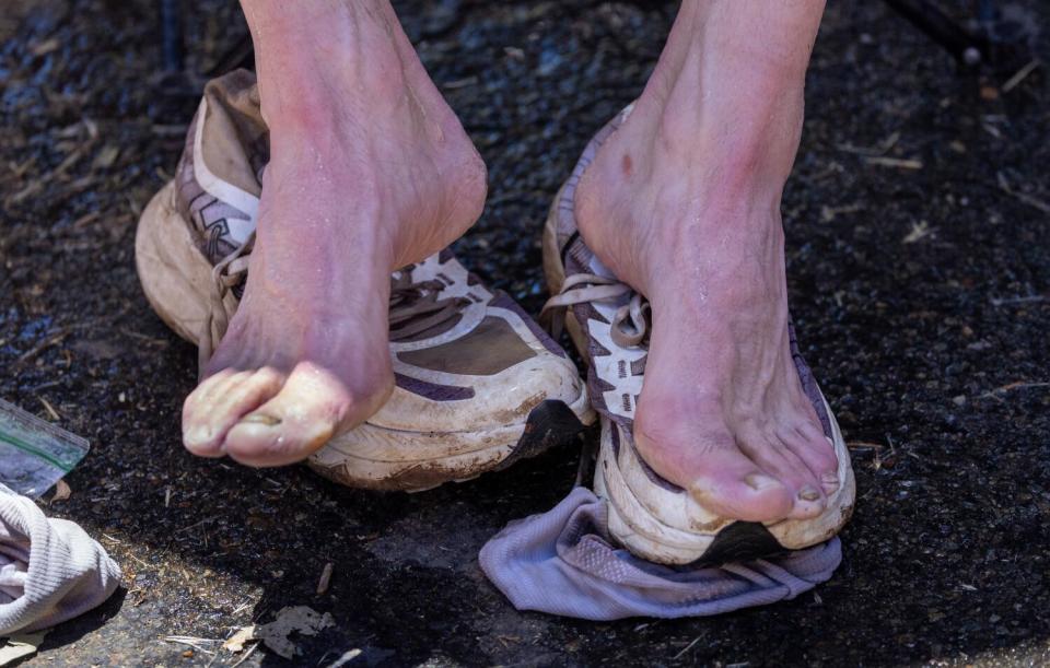 Front-runner Jim Walmsley rests his blistered feet during a stop at the Michigan Bluff aid station.