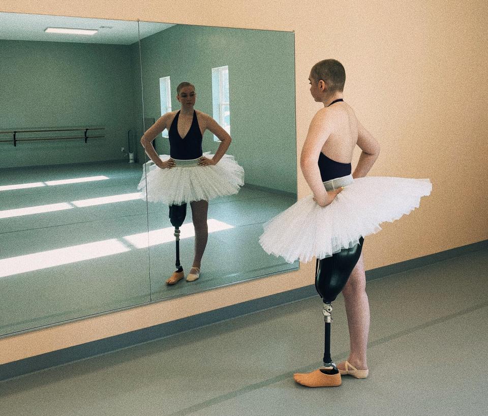 Ballet Dancer Kara Skrubis Continues Dance Following Bone Cancer, Amputation: ‘I Never Gave Up’