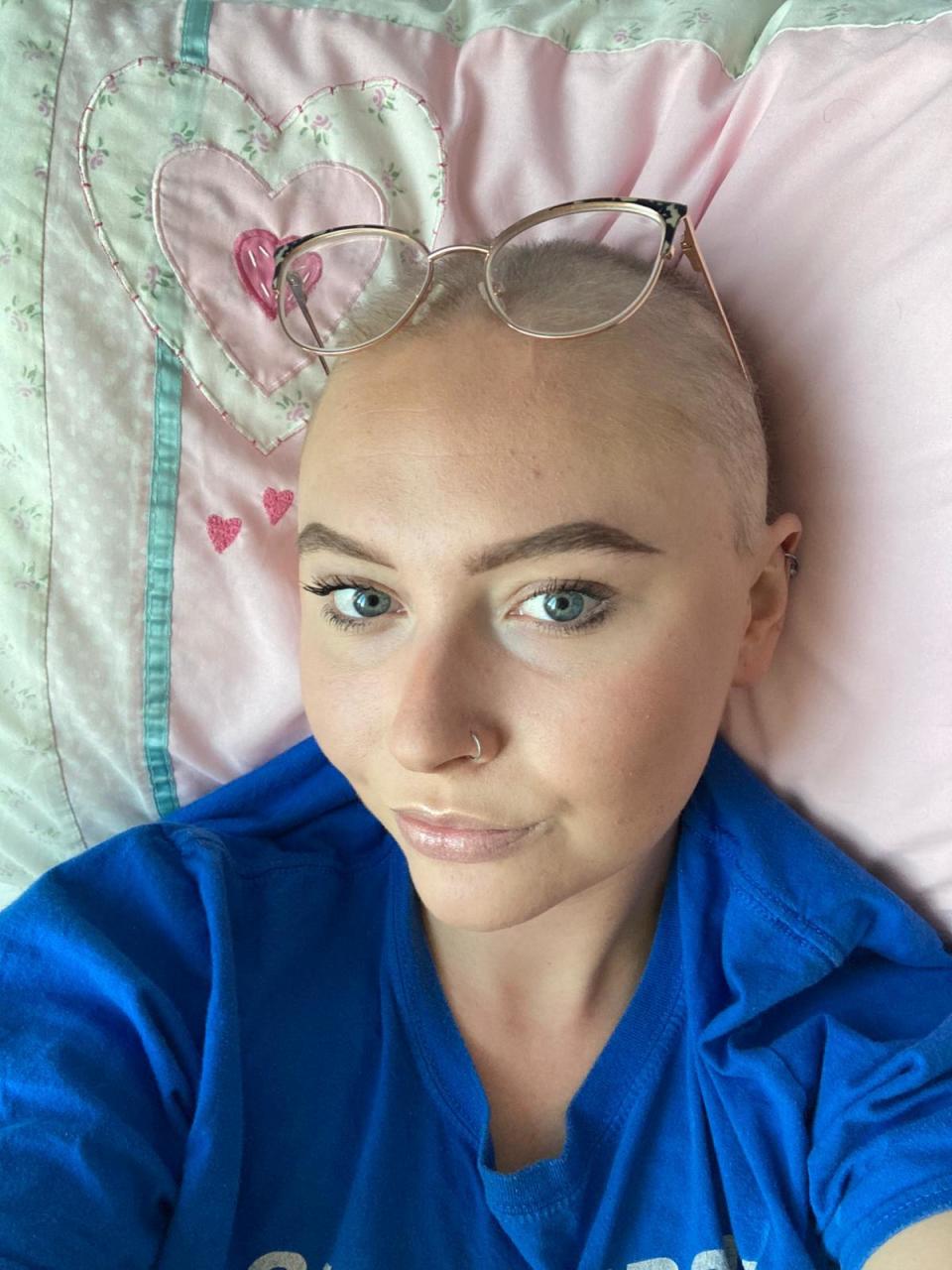 Eloise after chemotherapy hairless.
